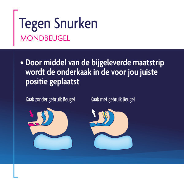 Shiepz Tegen Snurken Mondbeugel SHI00014 - 4